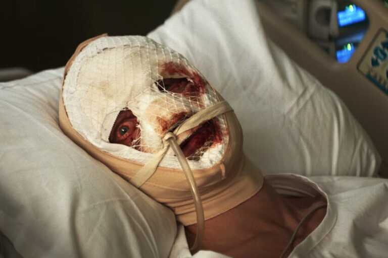 Matt Hagen en el hospital en Clayface